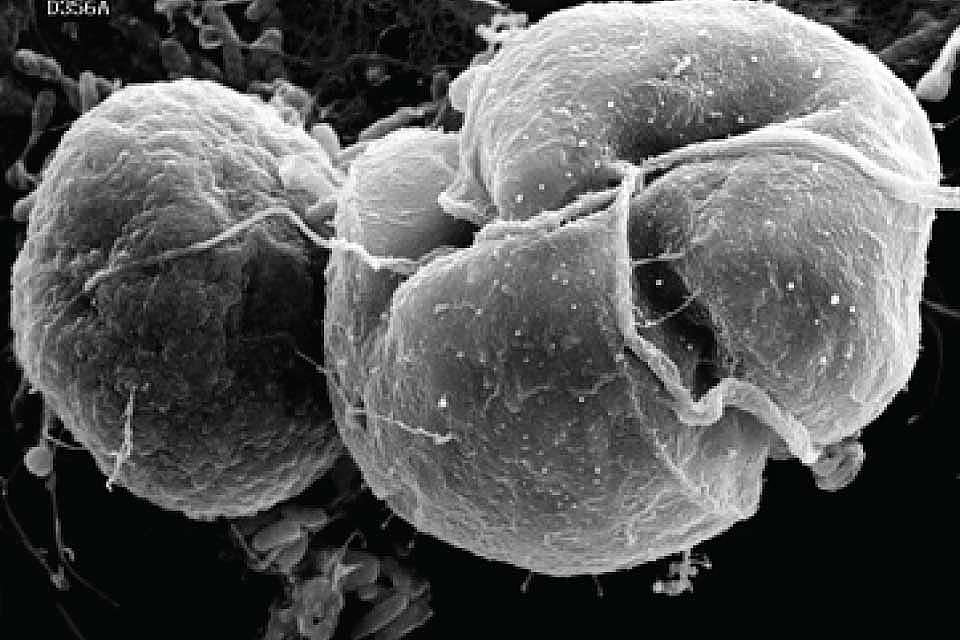 Scanning electron microscope image of the dinoflagellate Karlodinium veneficum (right) feeding on a cryptomonad-type alga Rhodomonas — an example of mixotrophy. From Place et al. 2012, Harmful Algae 14:179–195. Credit: Vince Lovko, Virginia Institute of Marine Science.